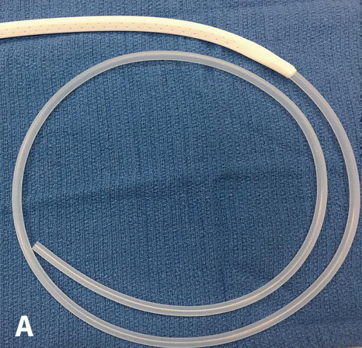 Clinical Image What Type of Drain Is Shown Here?