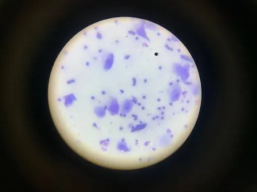 B: Preputial cytology slide showing numerous round nucleated cells and angled anuclear cells. C: Preputial cytology slide showing round nucleated cells and numerous clumped neutrophils.