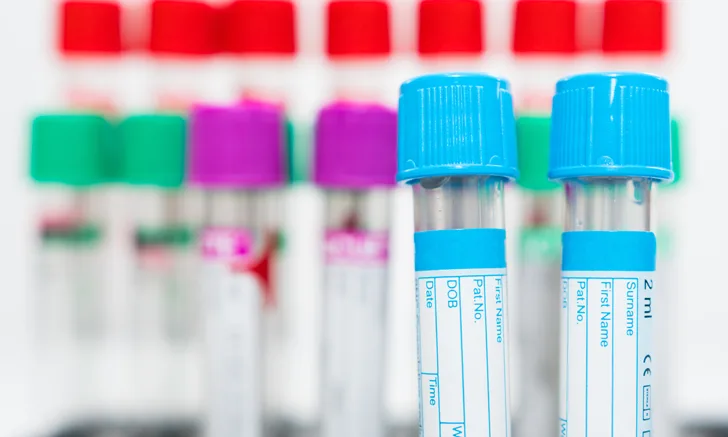 A close-up view of several blood collection tubes in various colors, with a focus on a blue-labeled tube in the foreground. The labels on the tubes include fields for patient information, indicating their use in veterinary diagnostics.