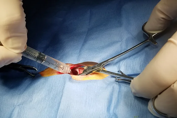 Gloved hands holding a small draped incision site open with hemostats while injecting liquid from the syringe into the incision.
