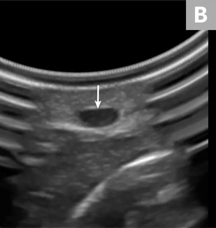 Gloved hands holding ultrasound probe over limb of pet and ultrasound image with arrow pointing to blood vessel.