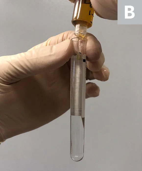 A hand holding a test tube to demonstrate the Rivalta test. 