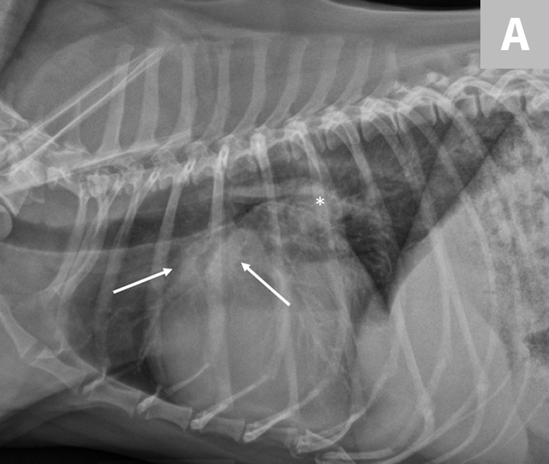 Congestive Heart Failure X Ray