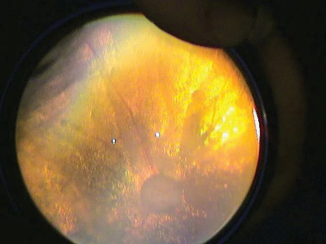 Featured Image