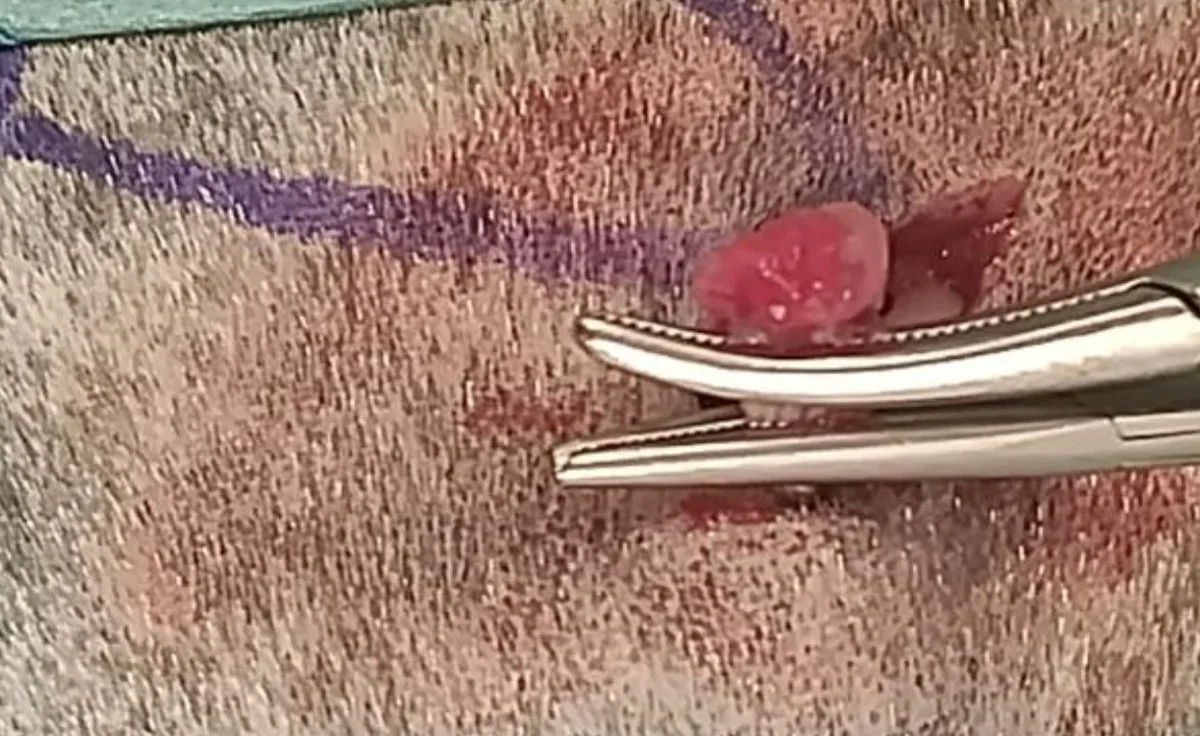 Two hemostats clamped over an ovarian pedicle placed dorsal to the exteriorized ovary.