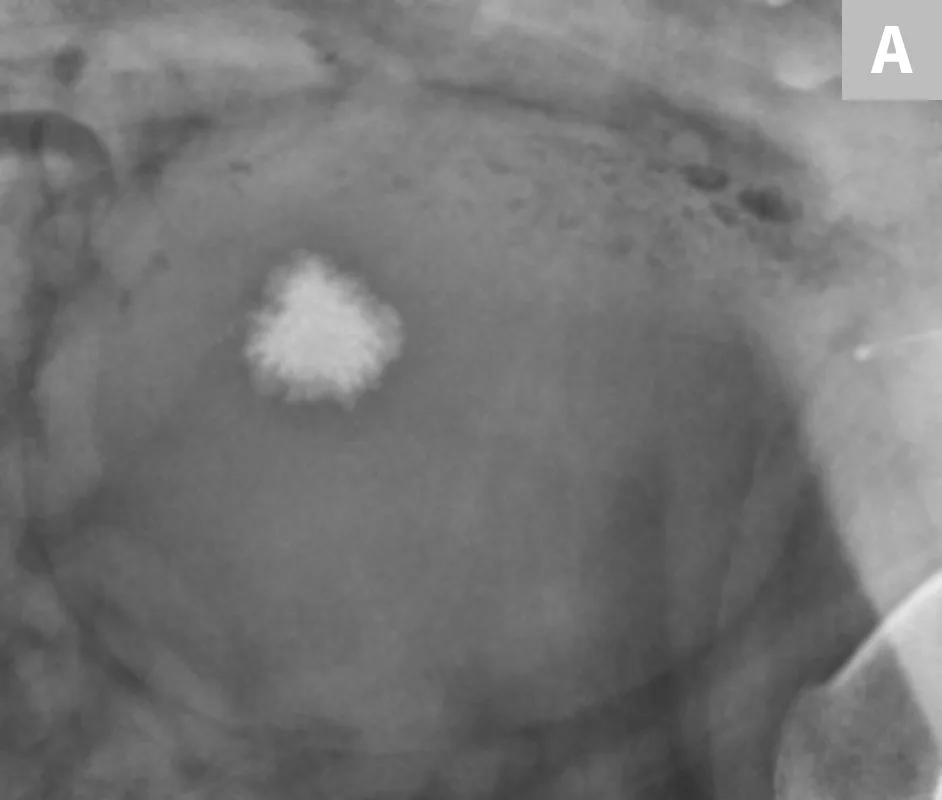 selected slide image