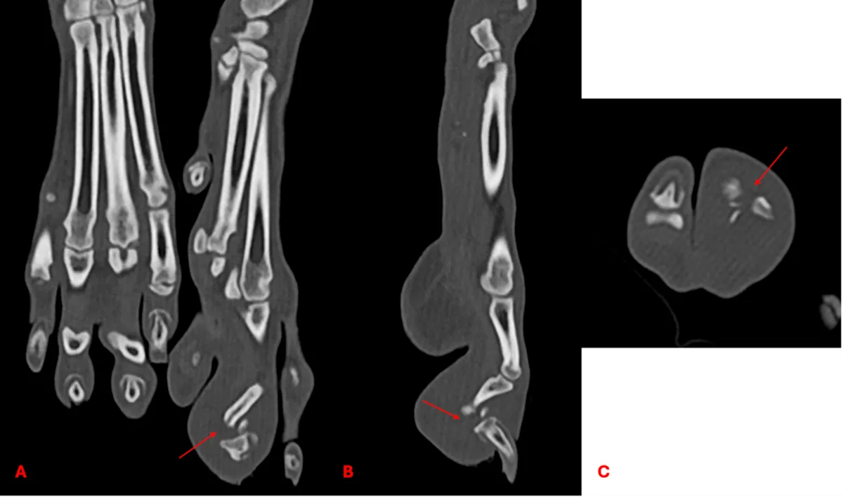 Three CT planar views showing a comminuted fracture of the third digit in a dog.