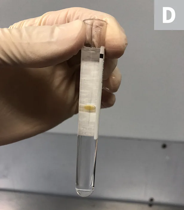 A hand holding a test tube to demonstrate the Rivalta test. 
