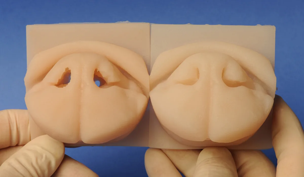 Side-by-side comparison of brachycephalic silicone models of a dog's nose before and after ala vestibuloplasty.