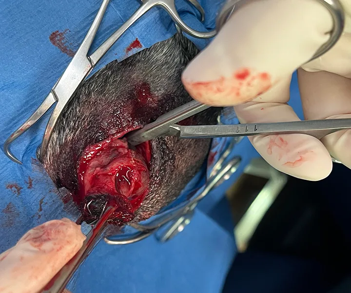 Eye retracted outwards while opened scissors are inserted into socket behind globe.