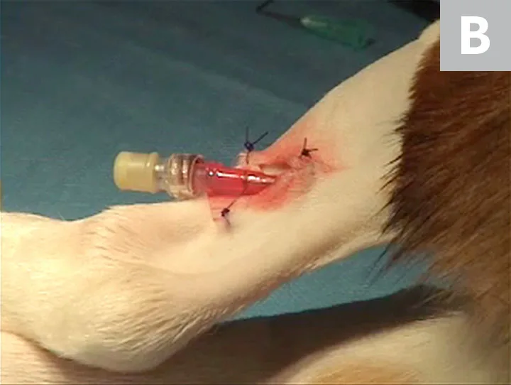 Three images demonstrating securing of catheter to skin and finished catheter placement on bandaged leg.