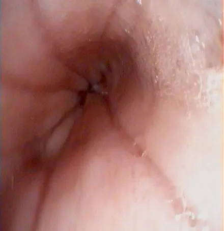 selected slide image