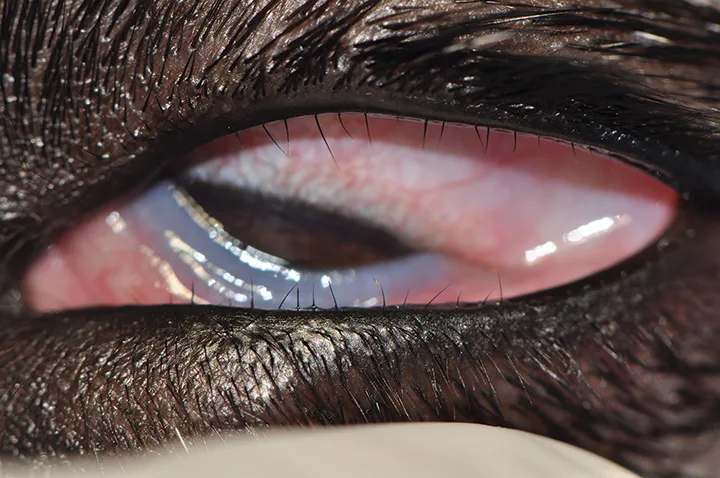 selected slide image