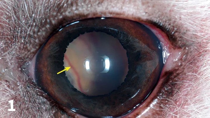 Close-up of dilated eye with arrow pointing to retina with blood vessels visible through pupil.