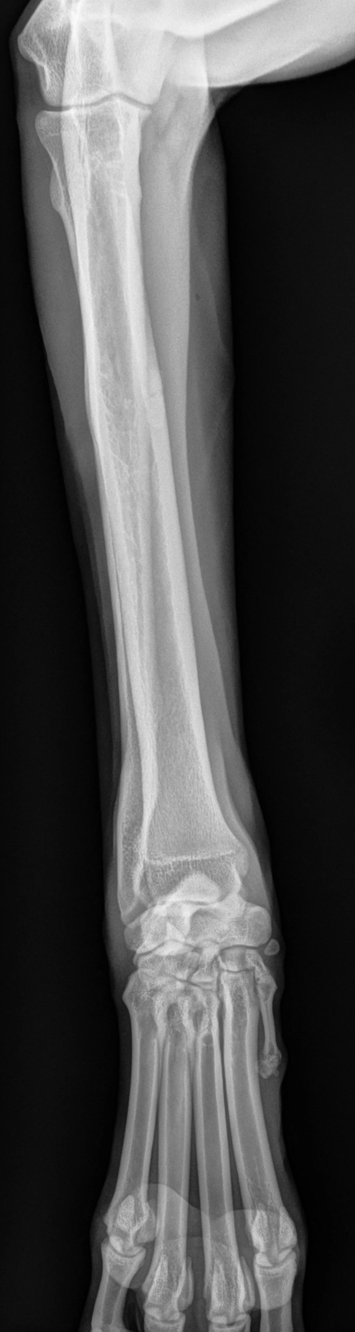 X-rays with arrows pointing to soft-tissue density swelling at distal aspect of dog antebrachium.