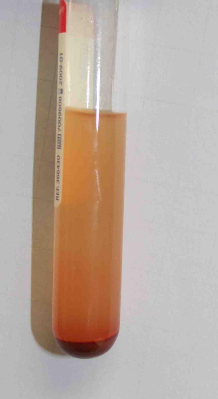 Skills for Technicians Urine Sample Collection & Analysis Clinician