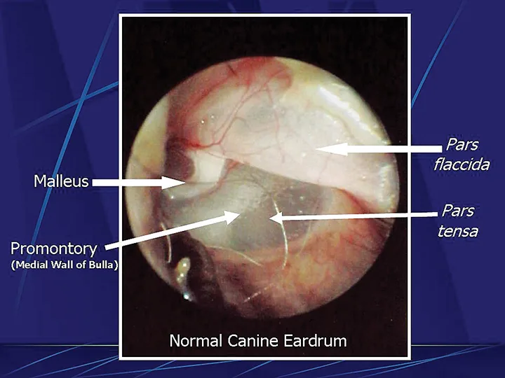 Otoscopic image of ear drum with arrows labeling individual structures.