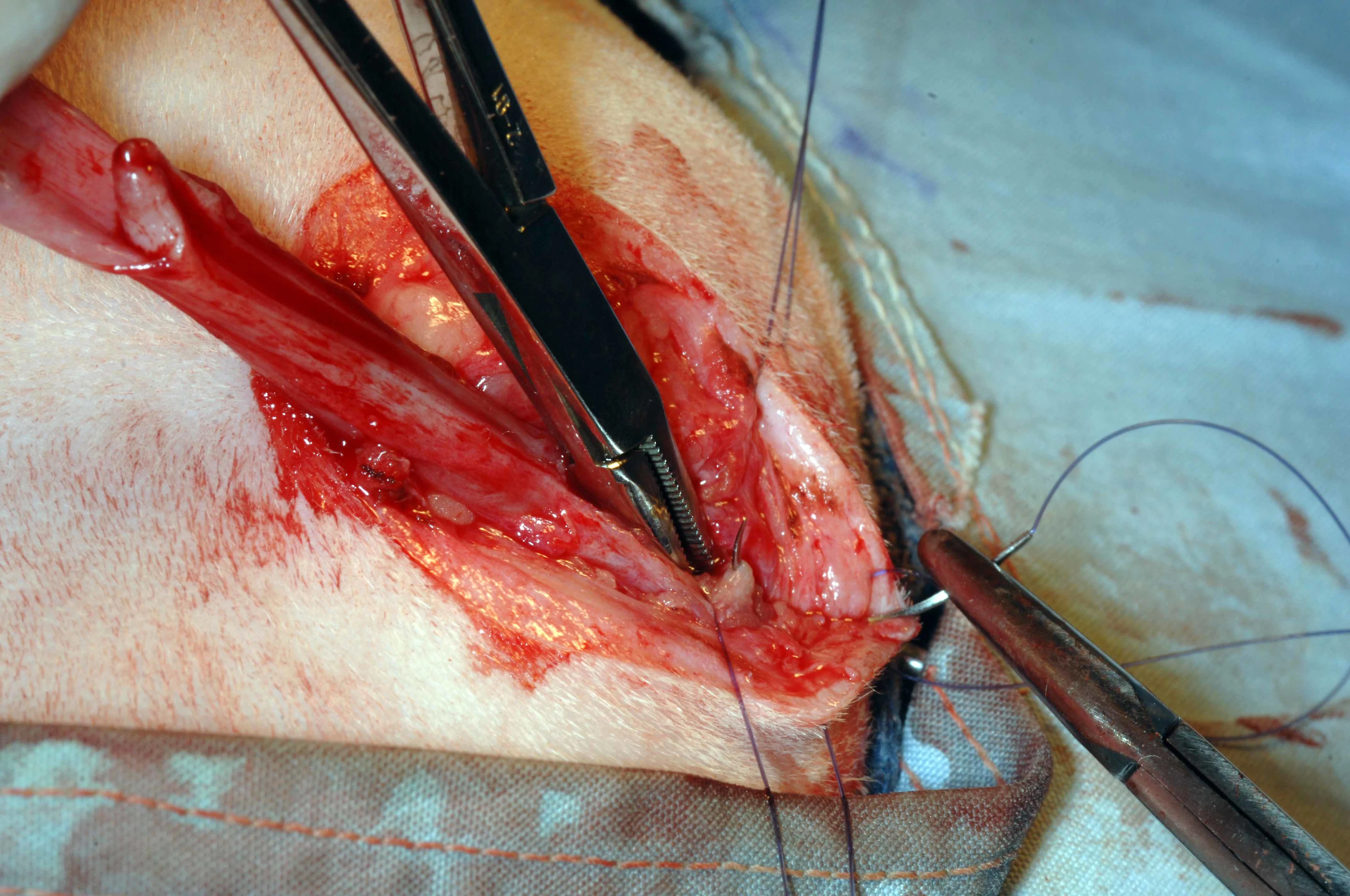 A: Intraoperative photo showing exposure of the urethral mucosa.  B: A surgeon is placing simple interrupted sutures between the skin and urethral mucosa.  C: Hemostats are used to separate the dorsal and ventral urethral mucosa during suturing