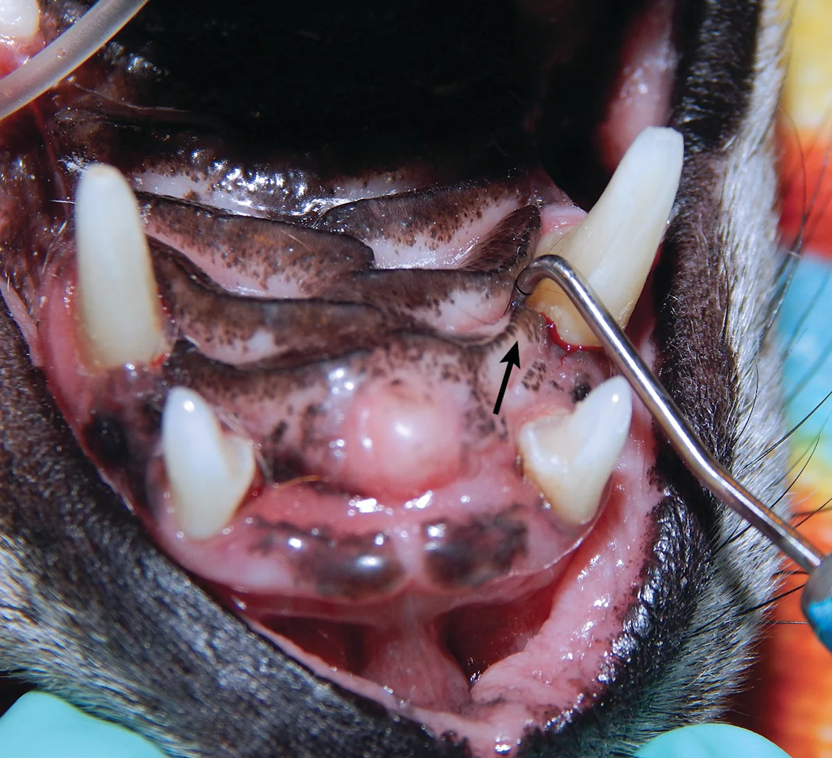 A dental probe inserted into a defect medial to the canine tooth in an anesthetized canine patient’s oral cavity.