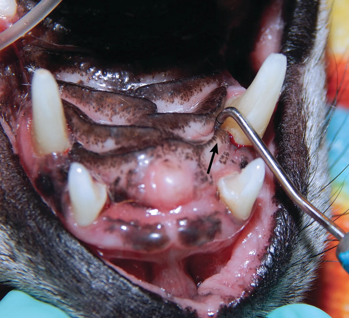 A dental probe inserted into a defect medial to the canine tooth in an anesthetized canine patient’s oral cavity.