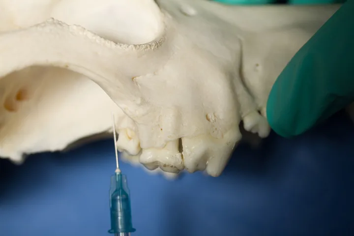 A right lateral view of a canine skull with a needle pointed dorsally just caudal to the maxillary second molar.