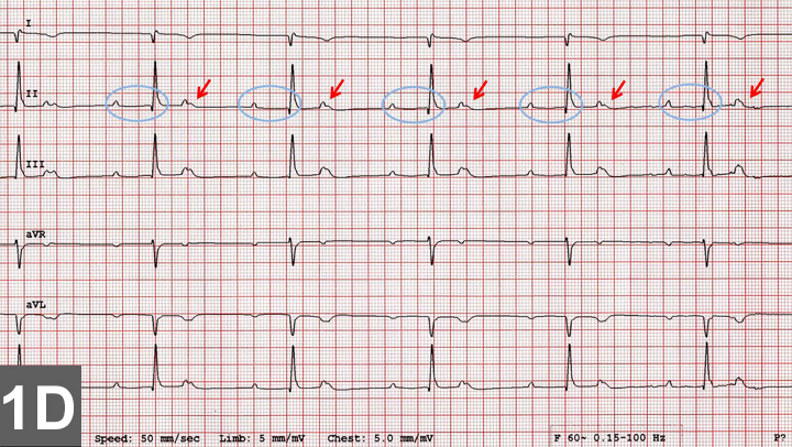洋書 CARDIAC ARRHYTHMIAS in Dogs and Cats Cardiac Arrhythmias in