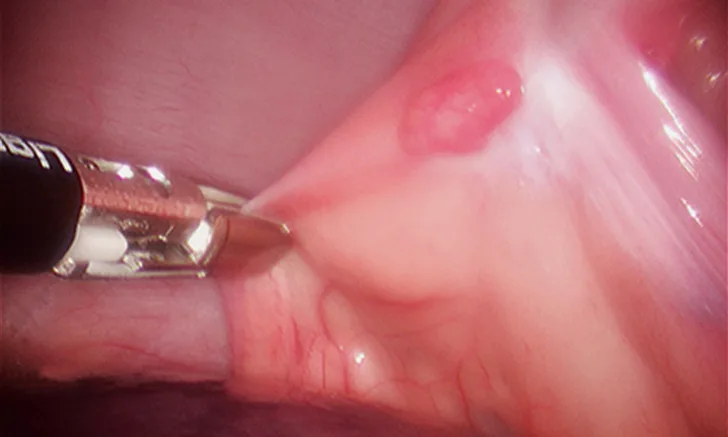 Featured Image