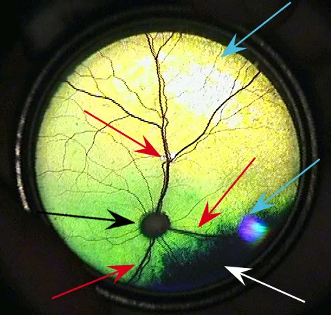 selected slide image