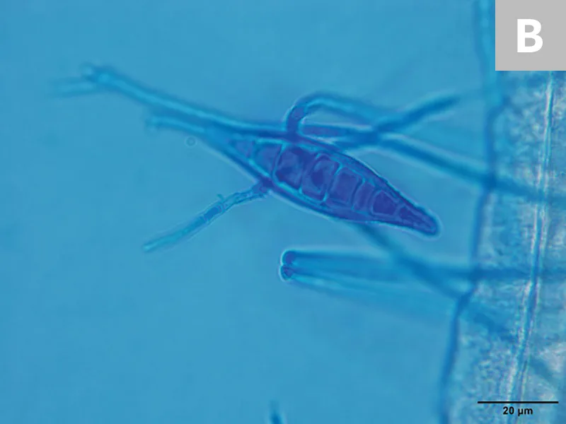 Cytologic appearance of M canis macroconidia at 2 different magnifications.