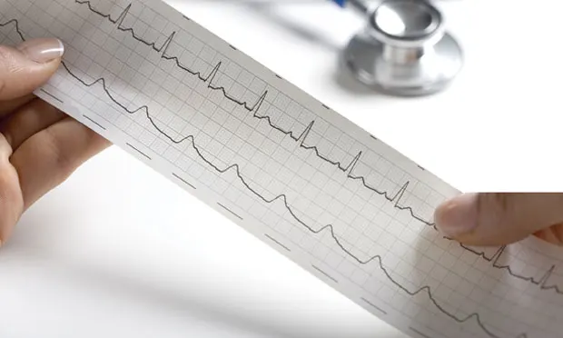 A veterinary team member’s hands holding a printed ECG strip.