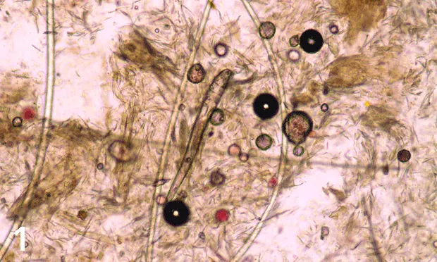 Microscopic image of an adult demodex mite.