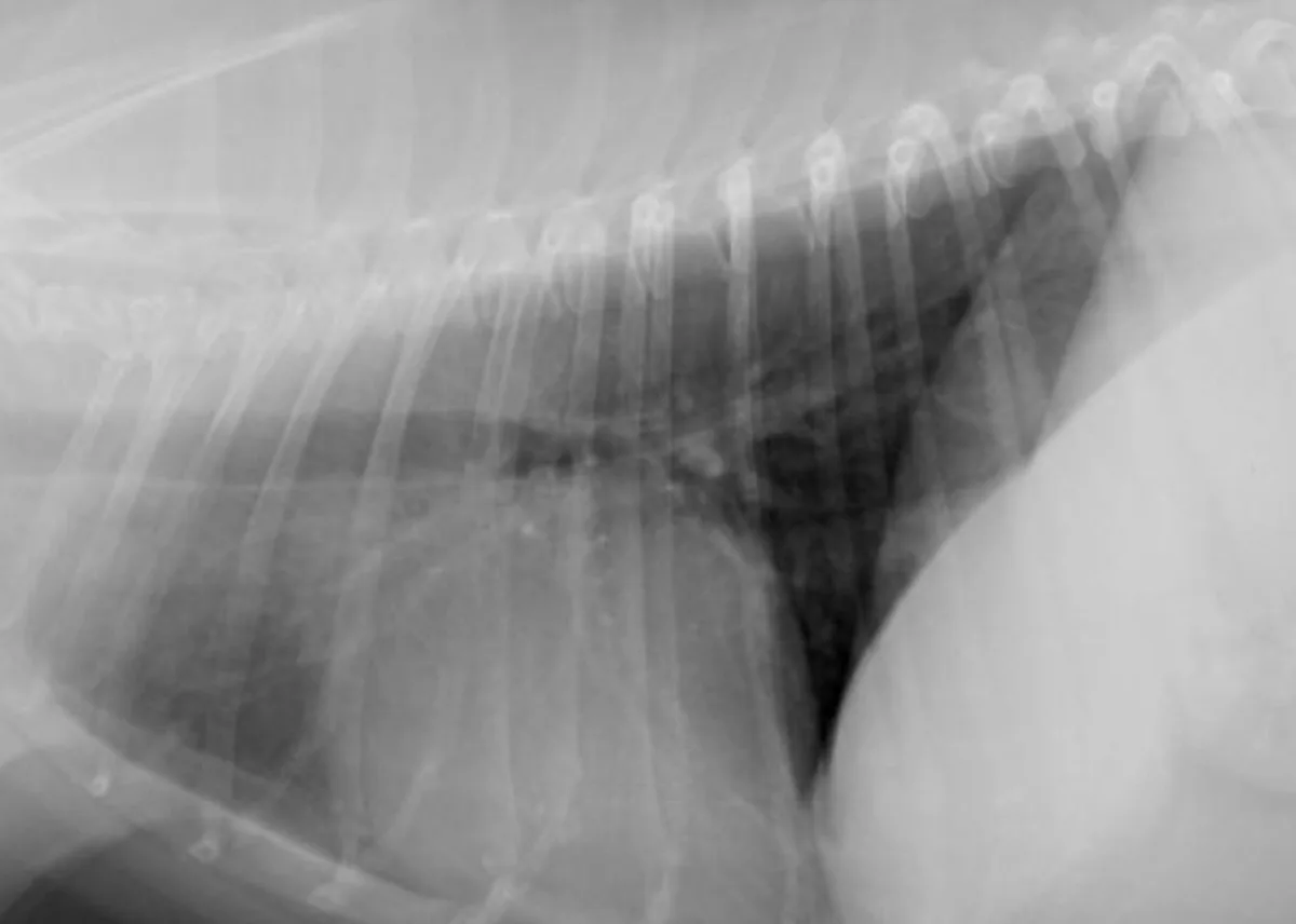 Inspiratory and expiratory lateral thoracic X-rays demonstrating how appearance changes with inspiration.