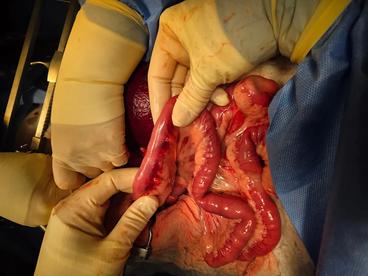 Intestinal surgery in a dog.
