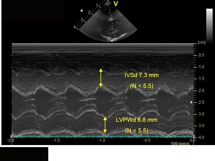 Echocardiography in General Practice Cardiac Abnormalities Clinician