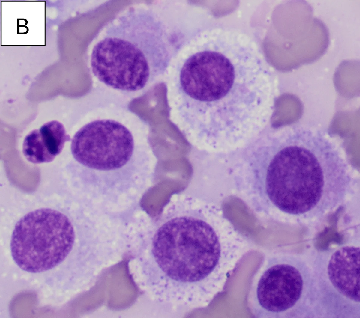 Cytology image of a cutaneous mass.