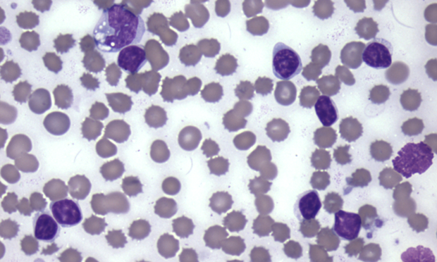 band neutrophil pathology