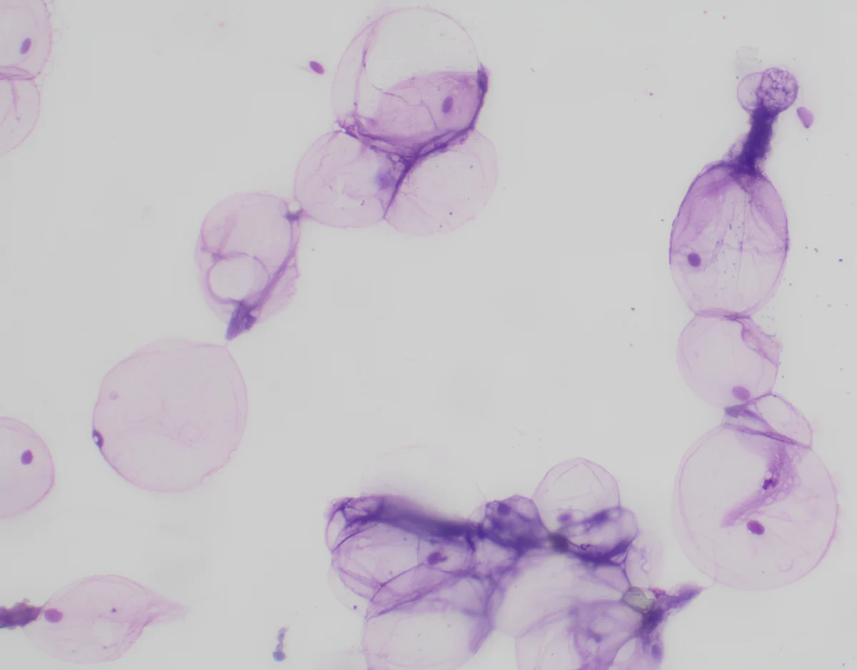 Round, thin-walled cells with light-pink cytoplasm and small, purple eccentric nuclei.