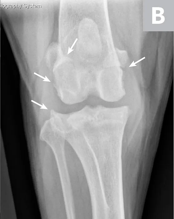 Labeled lateral and craniocaudal radiographs of right stifle showing pathologic features secondary to CCL rupture and medial meniscal tear.