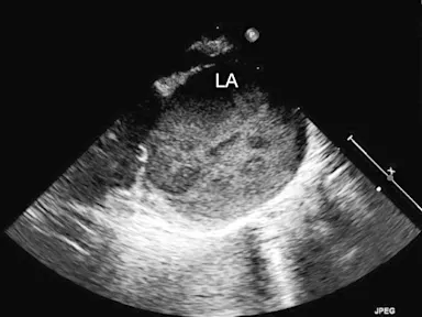 Acute Pelvic Limb Paresis & Respiratory Effort In A Cat