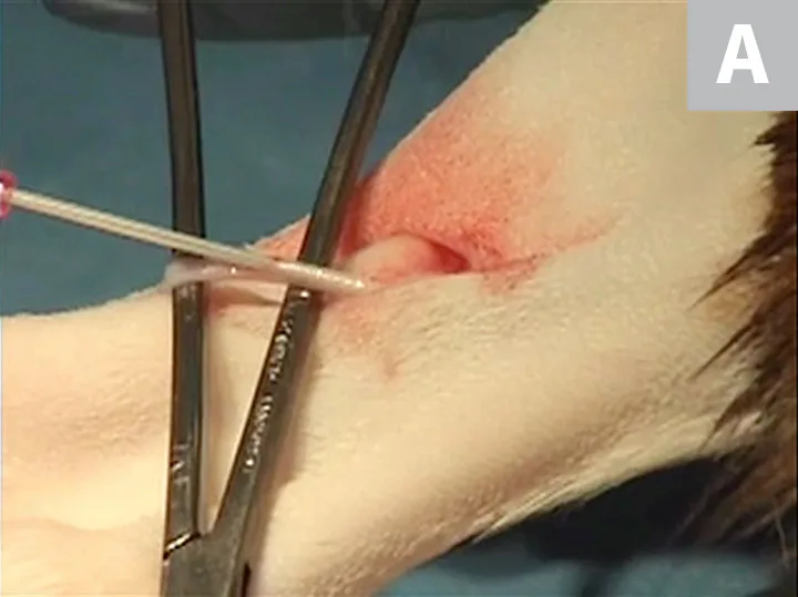 Two images showing insertion of catheter into saphenous vein and removal of the stylet.