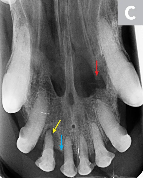 Three dental radiographs.