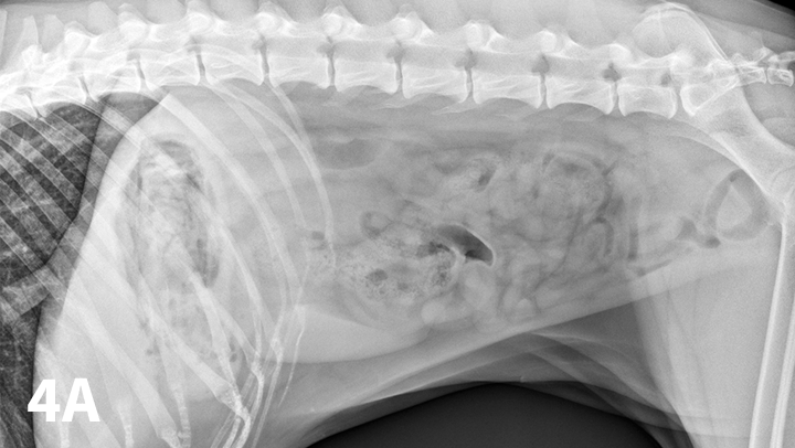 Top 5 Tips On Radiographic Diagnosis Of Obstructive Foreign Bodies Clinician s Brief
