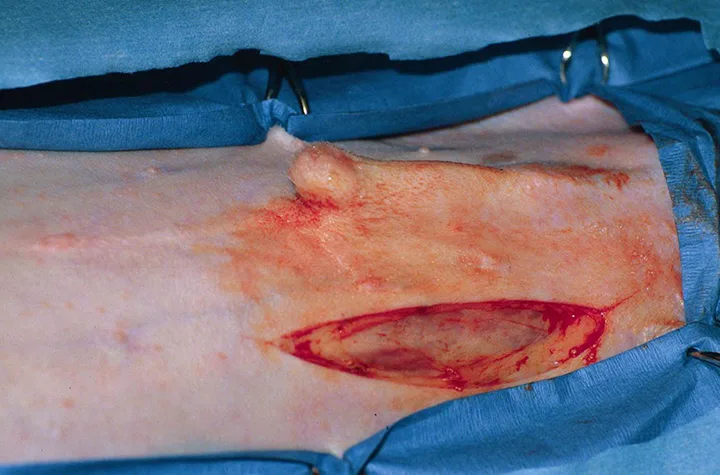 A draped canine surgery patient is shown with an incision made parallel and lateral to the prepuce.
