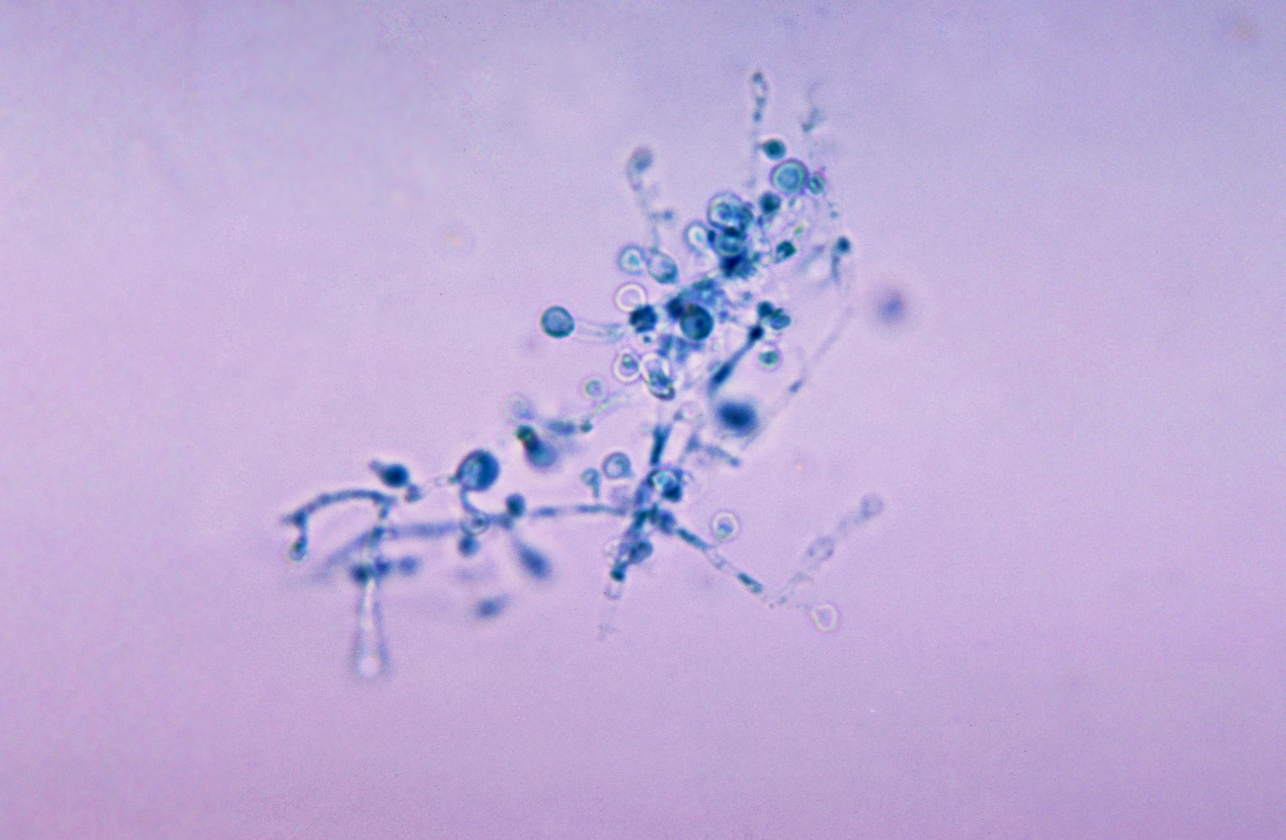 A microscopic image of a fungal organism.