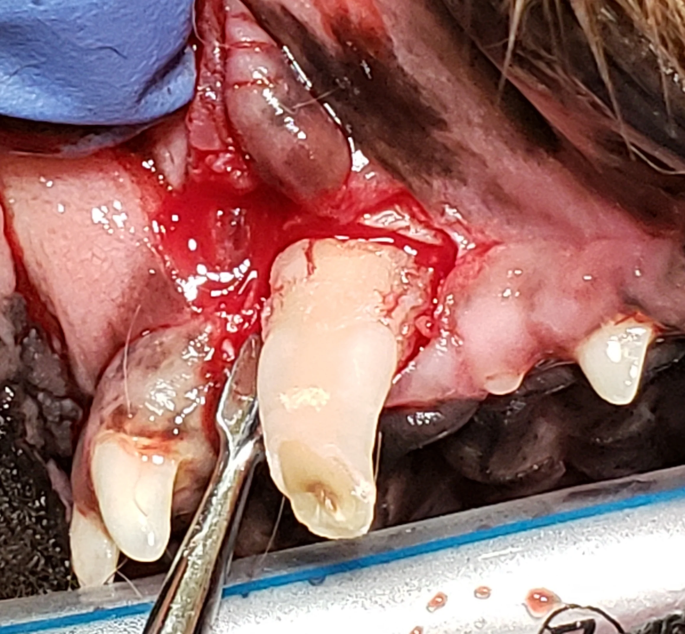 Winged dental elevator shown being inserted into periodontal ligament space around canine tooth root.