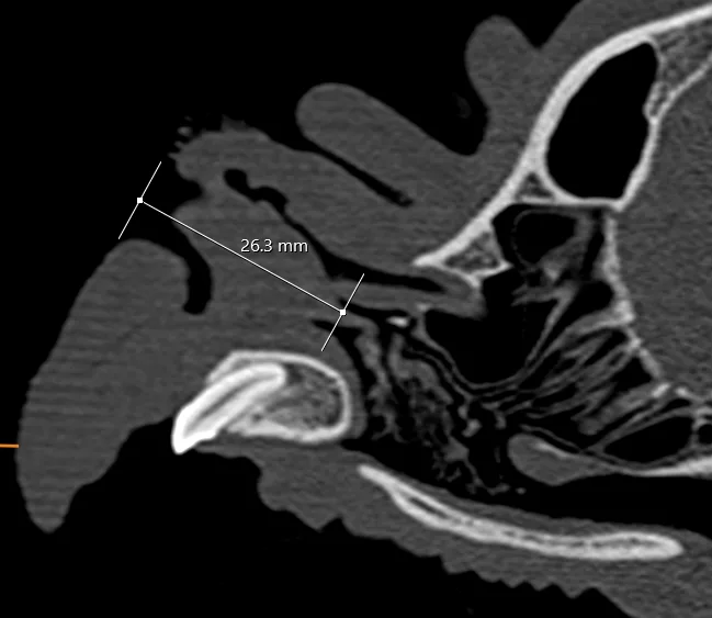 CT image of the alar fold in a dog with anatomic landmarks labeled.