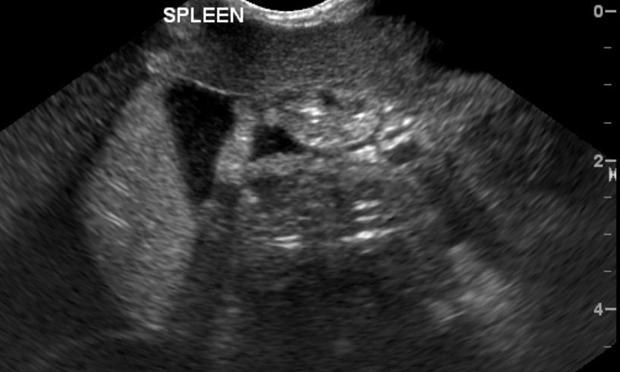 FAST in Emergent Patients