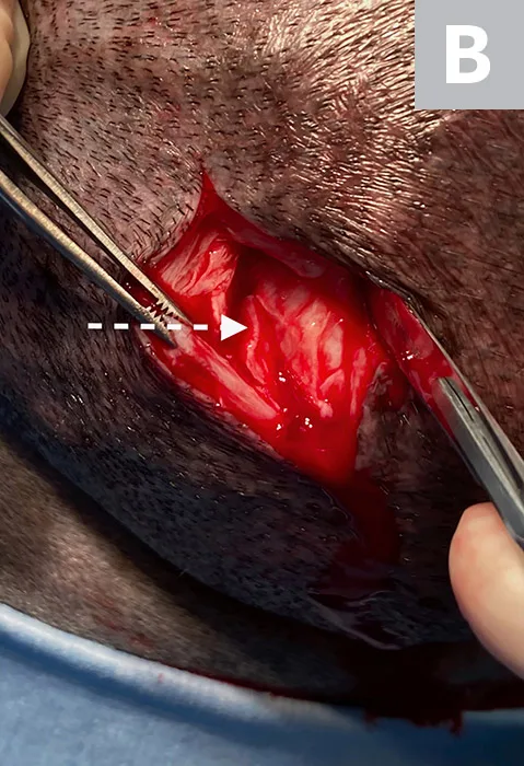 Two images showing open skin incisions with arrows pointing to where incisions into tumors should be made.