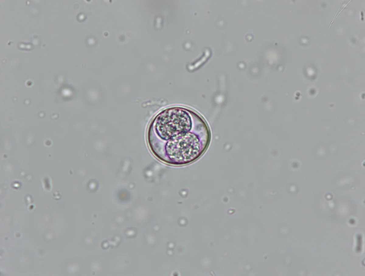 Slide showing an oocyst.