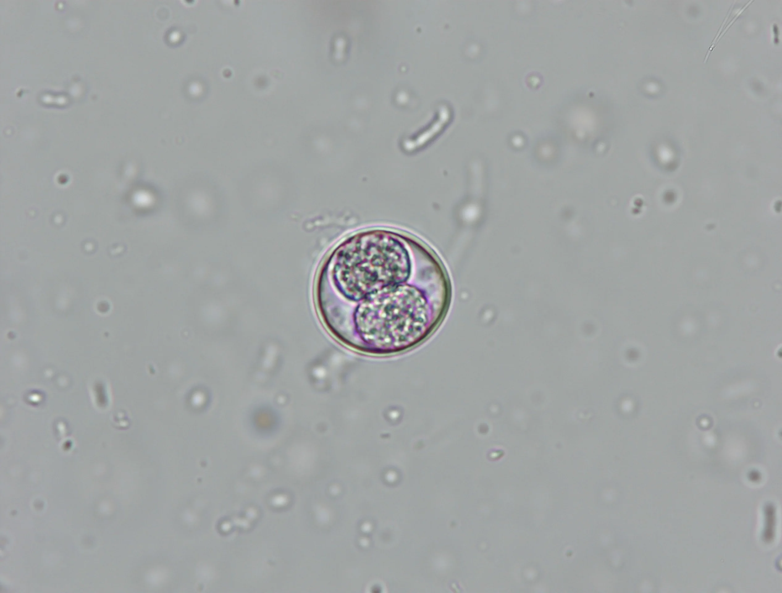 Slide showing an oocyst.